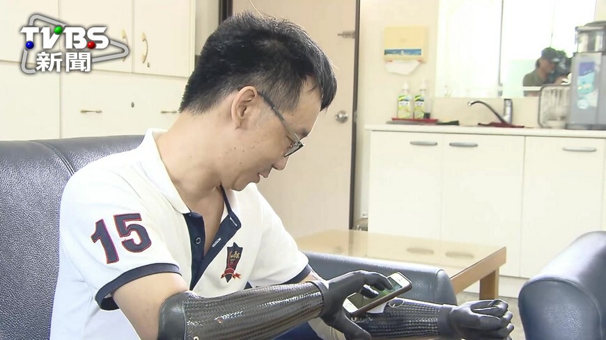 爬山染怪病命危！中山大學師截四肢重返校園（TVBS）圖片
