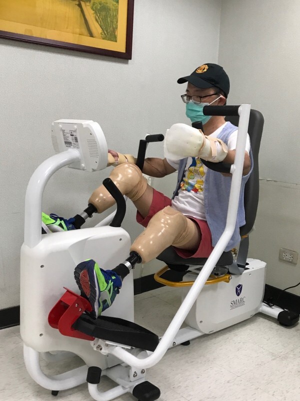 王致遠成功接受雙臂移植手術，成為台灣首例，正積極復健中。（王致遠提供）圖片