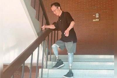 中山大學助理教授王致遠因感染截去四肢，雙腿裝上義肢，成為台灣首例「雙臂異體移植者」。記者徐如宜／攝影圖片