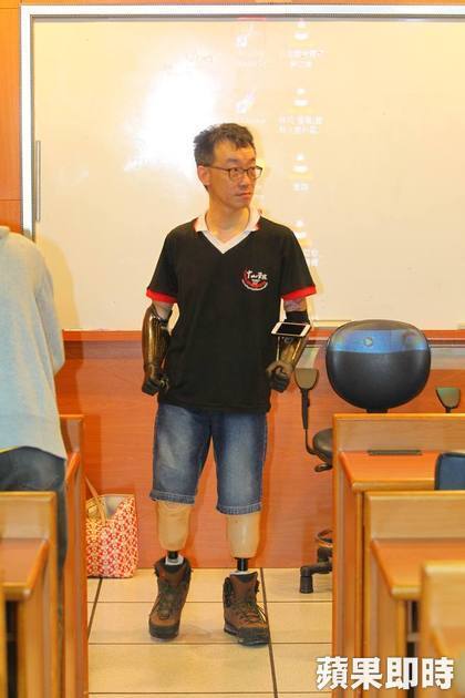 王致遠四肢截肢後裝上電子手臂及義肢。楊適吾攝圖片